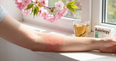 adjusting allergy medications first
